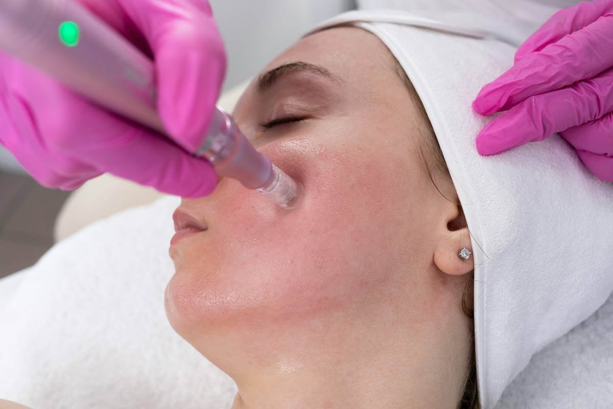Skin Tightening Facial Tool: 7 Proven Ways to Avoid Painful Mistakes